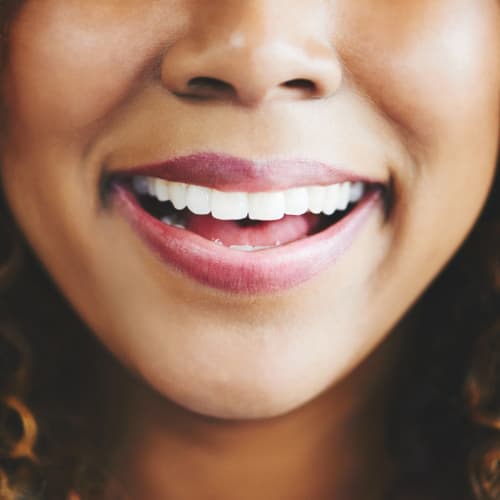 Woman's smile with bright, white teeth thanks to teeth whitening in Seattle that boost her confidence