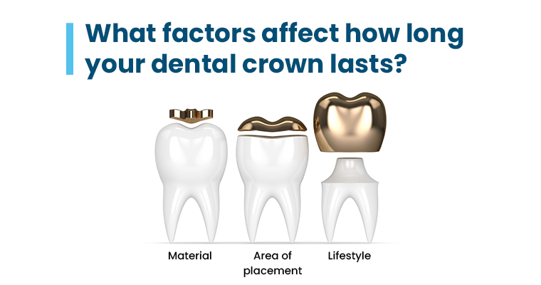 What factors affect how long your dental crowns last