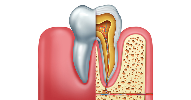 A cross-section of a root canal